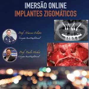 Imagem de capa para o Curso online SIMPLE 4 ZYGOMA