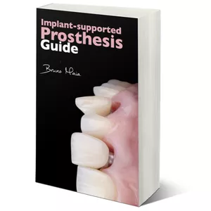 Cover image for Ebook E-book Implant-Supported Prosthesis Guide