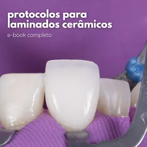 Imagem de capa para o Ebook Protocolos para laminados cerâmicos