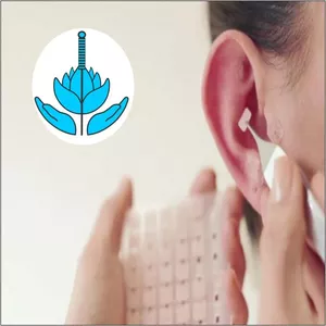 Imagem do curso ACUPUNTURA AURICULAR &amp; AURICULOTERAPIA