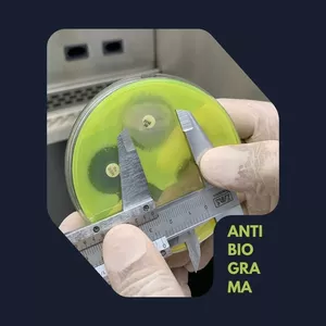 Imagem de capa para o Curso online Antibiograma e Brcast: aplicando a rotina e padronizando os testes de sensibilidade
