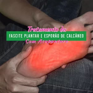 Imagem de capa para o Curso online Curso Como tratar Fascite Plantar e Esporão de Calcâneo com Acupuntura