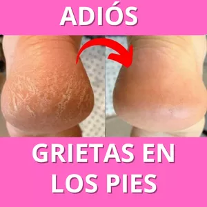 Imagen de portada para Ebook protocolo adiós grietas en los pies