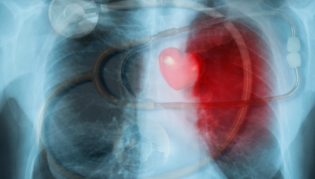 RAIO X PRÁTICO NA CARDIOPEDIATRIA 