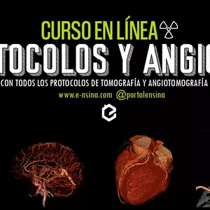 Imagen de portada para Curso online Diplomado AngioTC - Angiotomografía