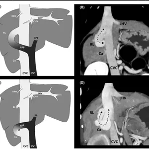 Imagem de capa para o Curso online Curso Avançado: Abordagem Clinica e cirúrgica do Shunt Portossistêmico em pequenos animais