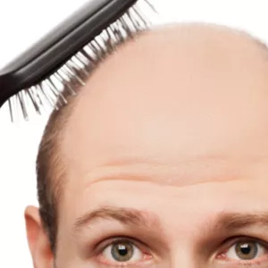 Imagem do curso Assistente em : Capilar NEW- Passo a Passo 