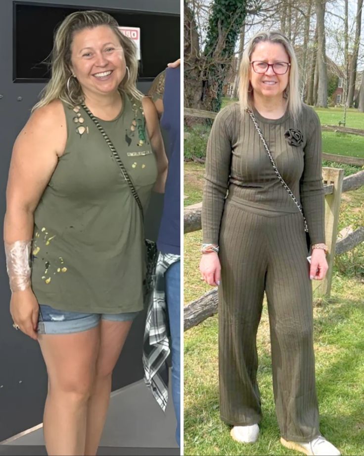 Gabriela F. – 54 años