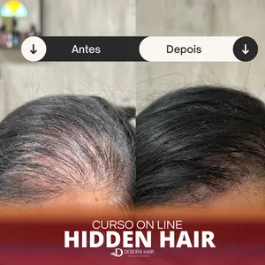 Imagem de capa para o Curso online HIDDEN HAIR
