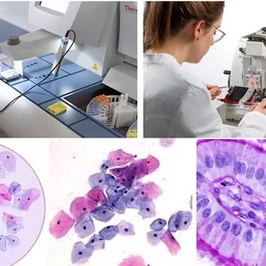 Imagem do curso Curso Extensão em Citologia Clínica e Patológica para Profissionais da Saúde