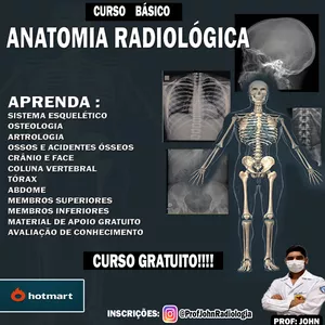 Imagem de capa para o Curso online ANATOMIA RADIOLÓGICA - AVANÇADO