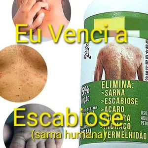 Imagem de capa para o Ebook Cura Escabiose (sarna humana)