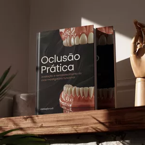 Imagem de capa para o Ebook Oclusão Prática: como restabelecer guias anteriores para o equilíbrio oclusal