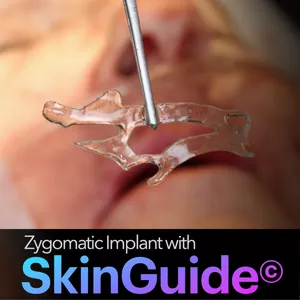 Cover image for Online course SkinGuide Concept for Zygomatic Implants 