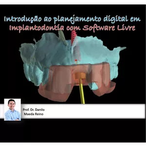 Imagem de capa para o Curso online  Introdução ao Planejamento digital em Implantodontia com software livre