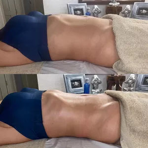 Imagen de portada para Curso online Drenaje Brasileño