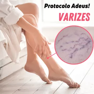 Imagem de capa para o Curso online Protocolo Adeus! Varizes