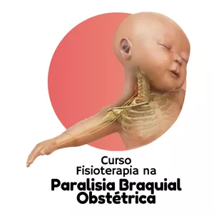 Imagem de capa para o Curso online Curso Fisioterapia na Paralisia Braquial Obstétrica