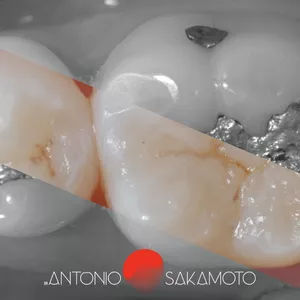 Imagem de capa para o Curso online Dossiê Completo das Restaurações em Dentes Posteriores