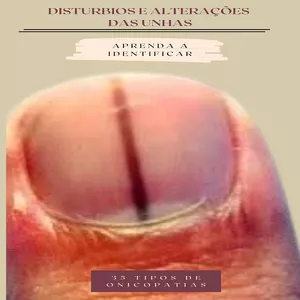 Imagem de capa para o Ebook DISTÚRBIOS E ALTERAÇÕES DAS UNHAS