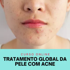 Imagem principal do produto Curso de Tratamento Global da Pele com Acne