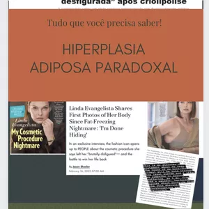 Imagem de capa para o Ebook Ebook Hiperplasia Adiposa Paradoxal- Tudo que você precisa saber! Hyperplasia! 