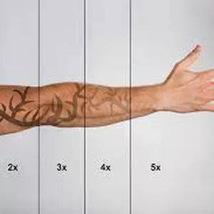 Cover image for Online course Laser Tattoo Removal Supplementary Course