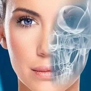 Imagem de Curso online de Radiologia Odontológica criado por AprendeSpot na hotmart