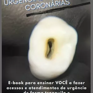 Imagem de capa para o Ebook Sobrevivendo às urgências e aberturas coronárias 