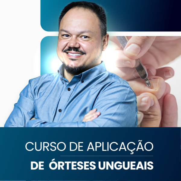 Imagem de Curso de Aplicação de Órteses Ungueais na Prática criado por Projeto Jonas Ibrap na hotmart