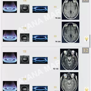 Imagem de capa para o Ebook PARÂMETROS DE QUALIDADE DA IMAGEM EM RESSONÂNCIA MAGNÉTICA