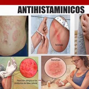 Imagen de portada para Ebook FÁRMACOS-PDF (Antihistaminicos) Enfermeria-2024