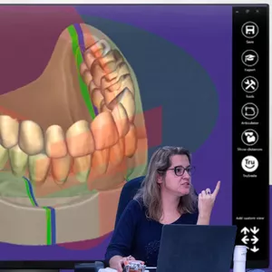 Imagem de Exocad - DETALHADO com Angélica Pires criado por Instituto do sorriso e implantodontia na hotmart