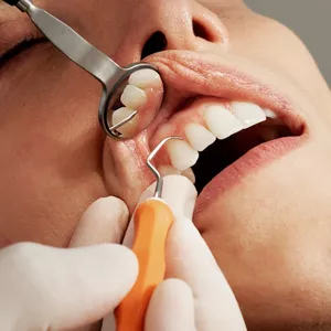 Imagem do curso Protocolo Oral Oncológico
