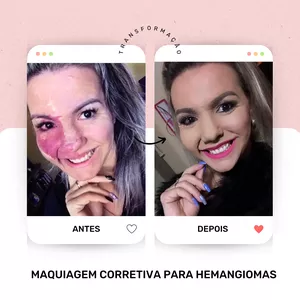 Imagem de capa para o Ebook Maquiagem corretiva para hemangioma 