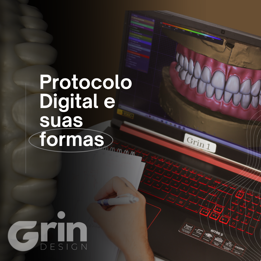 Protocolos Digitais - Modulo ibar no exocad (partial cad) - Estrategias Grin Design por Grin Design