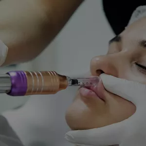 Imagen de portada para Curso online Hyaluron Pen: aumenta tus ingresos con estética no invasiva