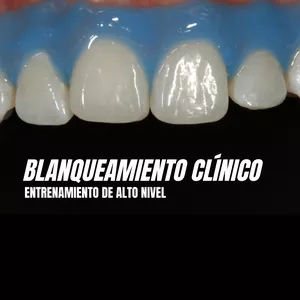 Imagen de portada para Curso online BLANQUEAMIENTO CLÍNICO