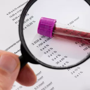 Imagem de capa para o Evento online Aula do Hemograma completo