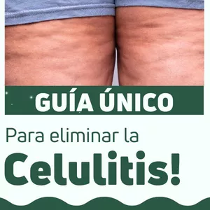 Imagen de portada para Ebook Guía Único para Eliminar la Celulitis
