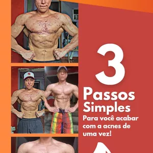 Imagem do curso ACABE COM AS ACNES EM 3 PASSOS SIMPLES
