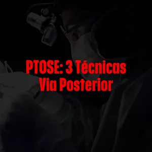 Imagem do curso Ptose: 3 Técnicas Via Posterior