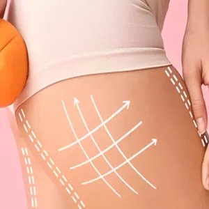 Imagen de portada para Curso online ZERO FLACIDEZ Y CELULITIS