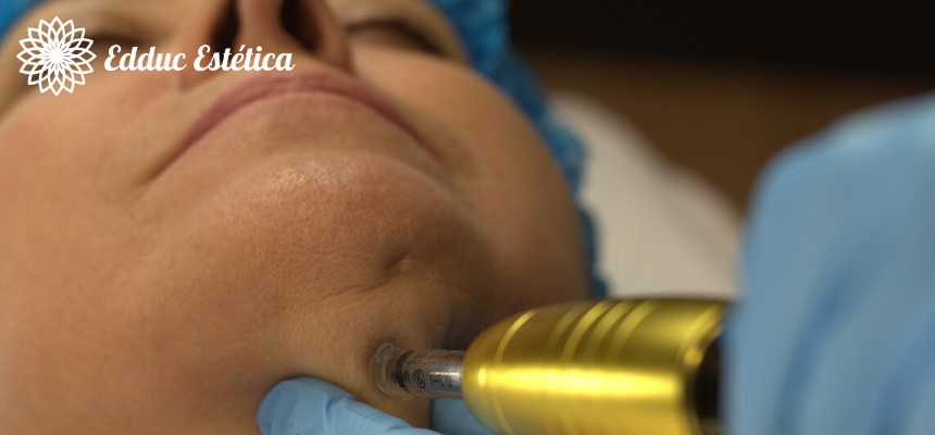 Tratamento de Papada com Intradermoterapia Pressurizada