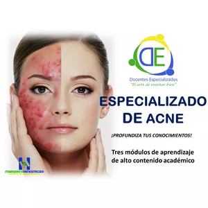 Imagen de portada para Curso online CURSO ESPECIALIZADO DE ACNÉ