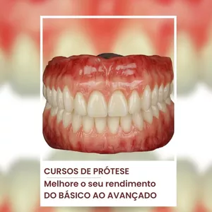 Imagem de capa para o Ebook APOSTILA COMPLETA DE PRÓTESE DENTÁRIA 