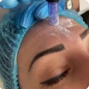 Imagem do curso DERMA HYALURON