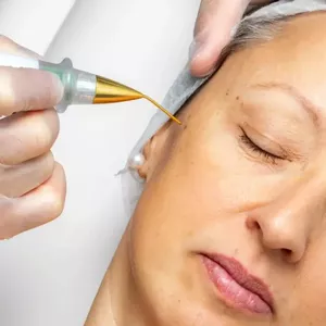 Imagen de portada para Curso online SKIN TAG, PAPILLOMA AND MILIA REMOVAL: Complete Training