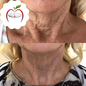 Imagen de portada para Curso online ANTI FLACIDEZ ™