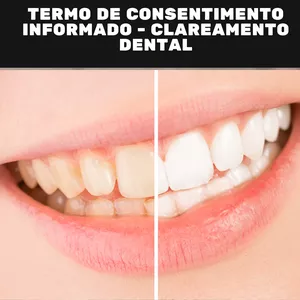 Imagem de capa para o Curso online Termo de Consentimento Informado - Clareamento Dental